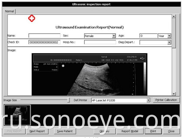 ultrasound equipment Touch Screen